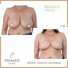 redukce MUDr. Martin Paciorek