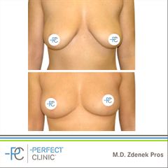 MUDr. Zdeněk Pros - Perfect Clinic