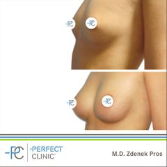MUDr. Zdeněk Pros - Perfect Clinic