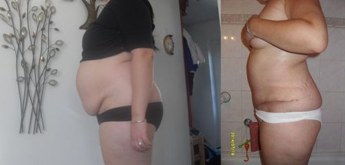 ab1