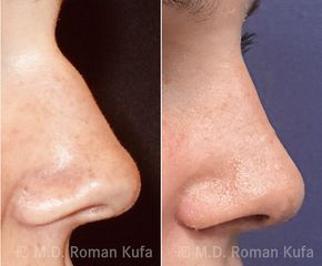 MUDr. Roman Kufa - Perfect Clinic
