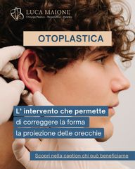 Dott. Luca Maione Otoplastica