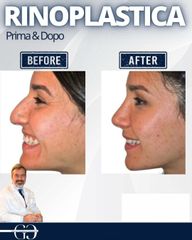 Dottor Gianluca Campiglio Rinoplastica