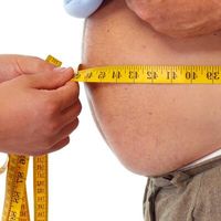 By-pass żołądka metodą walki z otyłością