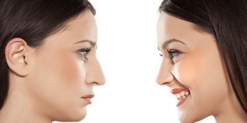 Piezo – ultradźwiękowa korekta nosa