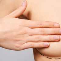 Rodzaje i pielęgnacja blizn po operacji powiększania piersi – wywiad z dr. Jakubem Kuleszą
