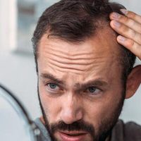 Sposób na łysienie – mikropigmentacja skóry głowy