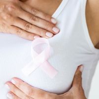 Profilaktyczna mastektomia: decyzja, która ratuje życie