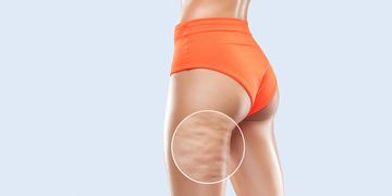 Liposukcja ultradźwiękowa: czym jest i czym różni się od tradycyjnej liposukcji