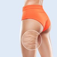 Liposukcja ultradźwiękowa: czym jest i czym różni się od tradycyjnej liposukcji