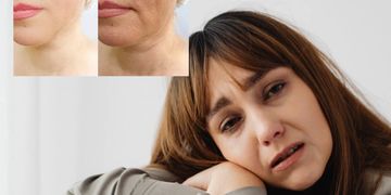 Czy hialuronidaza może trwale niszczyć nasze tkanki?