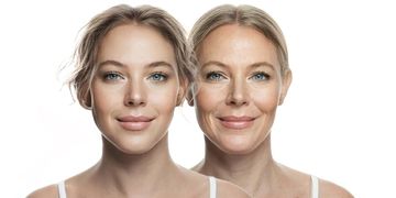 Jak długo utrzymuje się efekt endoliftingu i jak często należy go powtarzać? Jak długo utrzymuje się efekt endoliftingu i jak często należy go powtarzać?