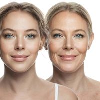 Jak długo utrzymuje się efekt endoliftingu i jak często należy go powtarzać?