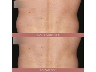 Kriolipoliza - Say WOW!