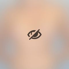 Blefaroplastyka nieinwazyjna Plexr - przed i po