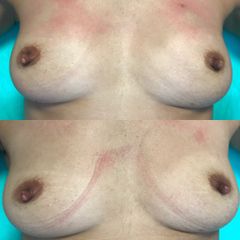 Mezoterapia - Dr Rafał Woś