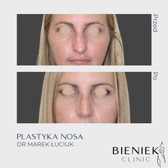 Korekta nosa - Dr n. med. Marek Łuciuk