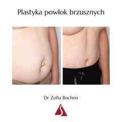 Plastyka brzucha - Klinika Dr Szczyt