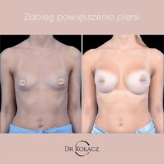 Dr n. med. Szymon Kołacz