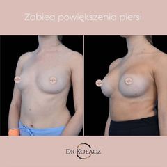 pow piersi