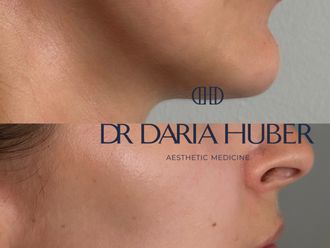 Wolumetria przed i po - 877423