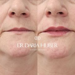 Pierwszorazowe modelowanie ust