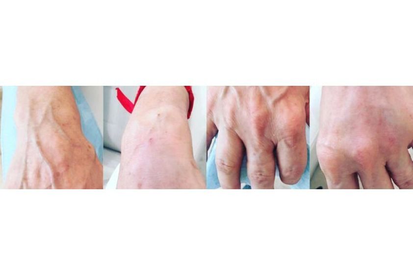 Anti-aging przed i po - 686124