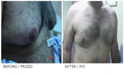 coollipo8