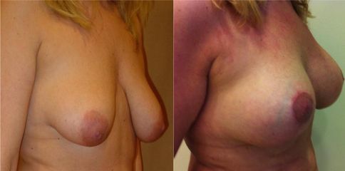 modelace3