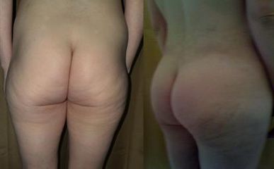 ultrazvuk20