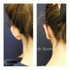 Korekcja uszu - lek. med. Guido Libondi