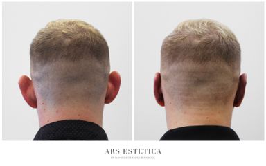Korekcja uszu - Ars Estetica