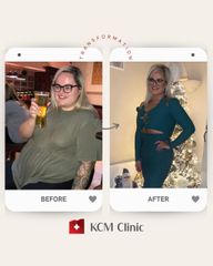 GASTRIC SLEEVE TRANSFORMATION - dr n. med. Grzegorz Kowalski