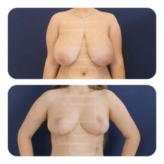 Metamorfoza sylwetki - dr Klaudia Libondi