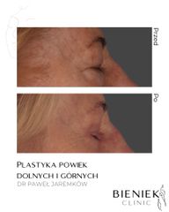 PLASTYKAPOWIEK_DRPAWEŁJAREMKOW