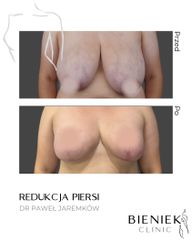 REDUKCJAPIERSI_DRPAWEŁJAREMKÓW