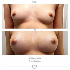 piersi_21