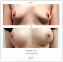 piersi_22