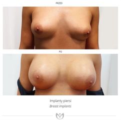 piersi_23