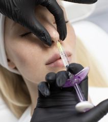 Modelowanie nosa kwasem hialuronowym