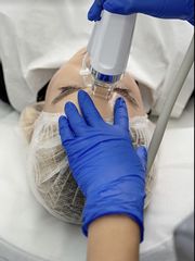 Zabieg Radiofrekwencja mikroiglowa