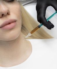 Fibryna bogatopłytkowa