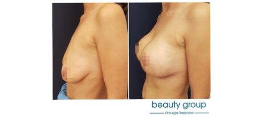 Operacje plastyczne - Beauty Group - Klinika Chirurgii Plastycznej