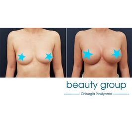 Beauty Group - Klinika Chirurgii Plastycznej