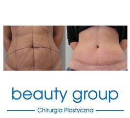 Beauty Group - Klinika Chirurgii Plastycznej