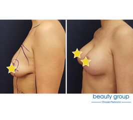 Beauty Group - Klinika Chirurgii Plastycznej