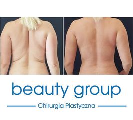 Beauty Group - Klinika Chirurgii Plastycznej