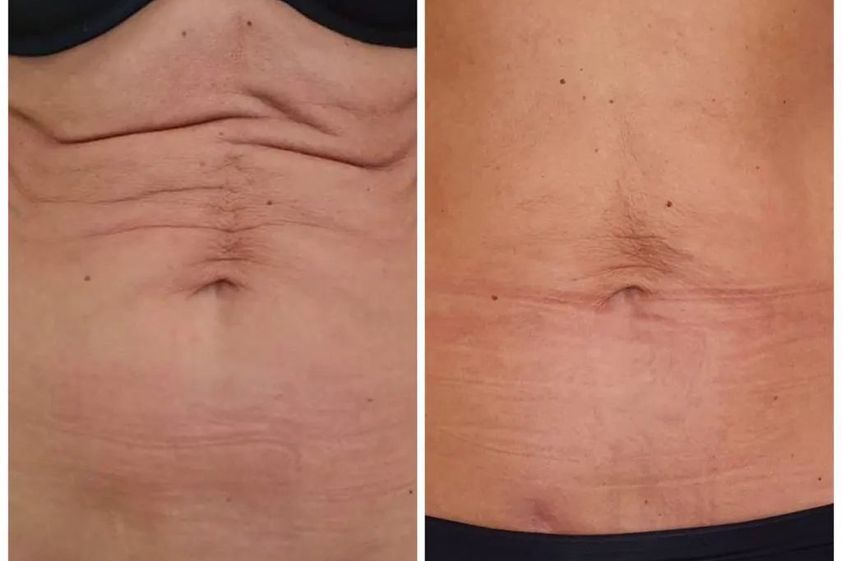 Anti-aging przed i po - 829437