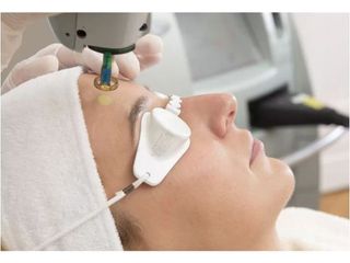 Skin Laser Lubelscy