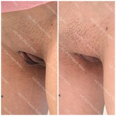 Labioplastyka dr n. med. Marcin Nylec